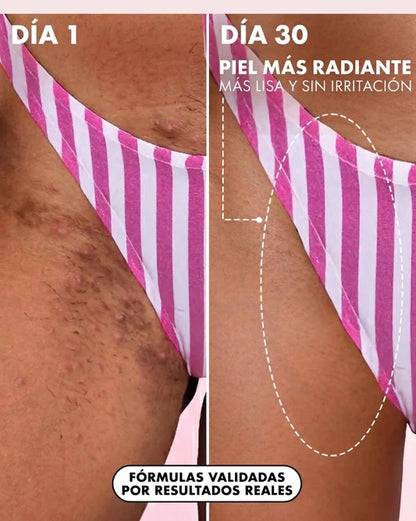 2x1 Aceite Truly Soft Serve Fresa | Hidrata, Elimina manchas y Vellos Encarnados💗