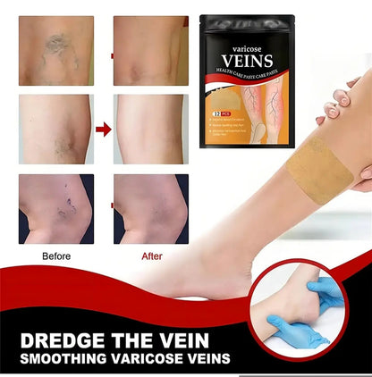 12 Parches de Alivio para Varices